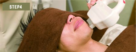 鼻下ヒゲ脱毛Step3